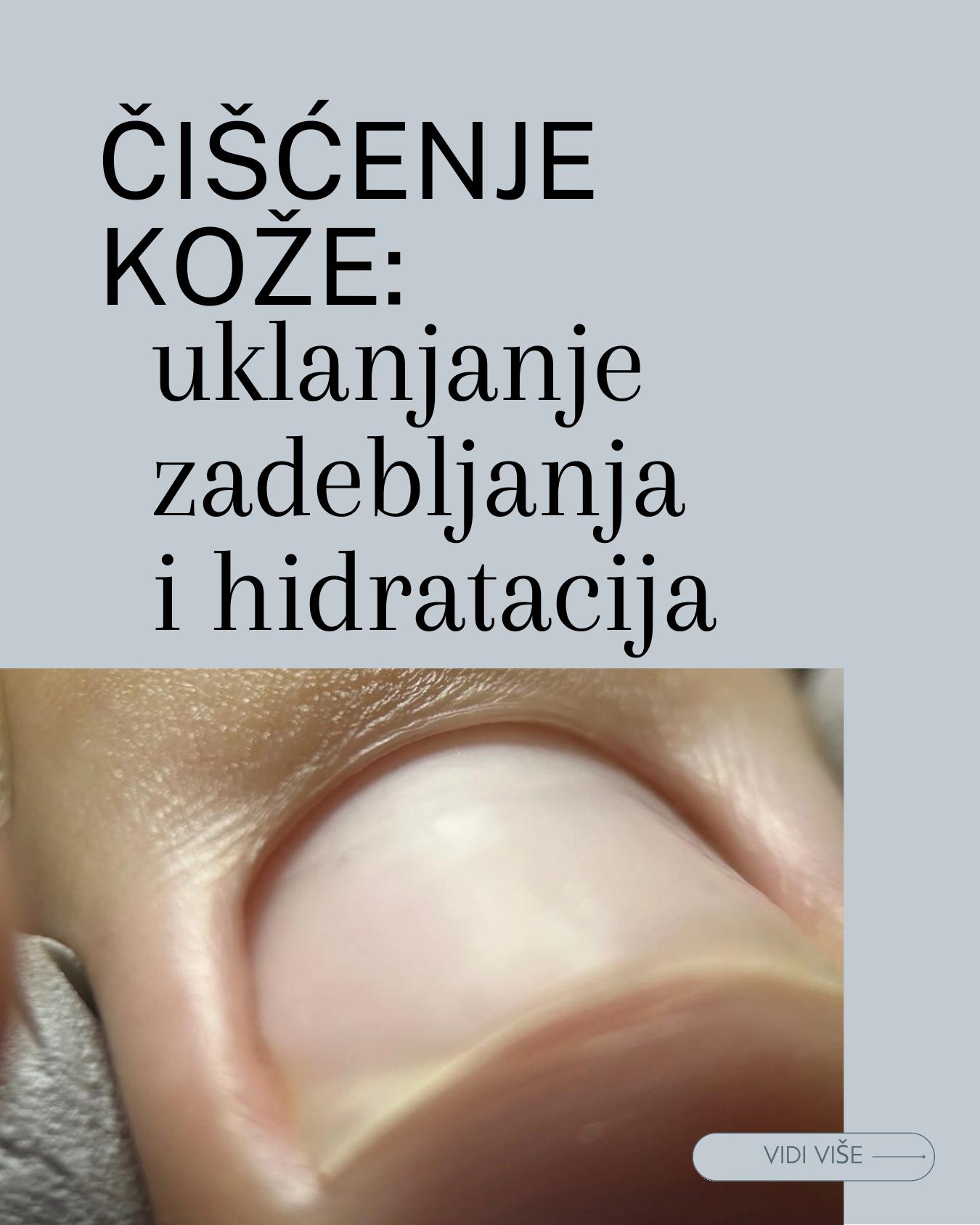 Detalji nokta